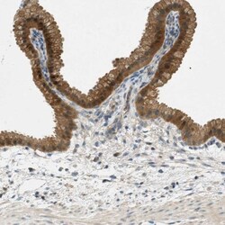 NUDT4 Antibody, Novus Biologicals 0.1mL; Unlabeled:Antibodies, Polyclonal